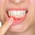 woman indicating gum irritation